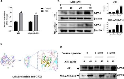 Anhydroicaritin Inhibits EMT in Breast Cancer by Enhancing GPX1 Expression: A Research Based on Sequencing Technologies and Bioinformatics Analysis